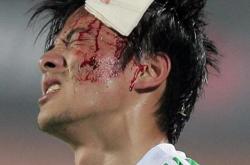 开云官方app入口-关于江苏舜天不敌深圳佳兆业，遭遇挑战的信息